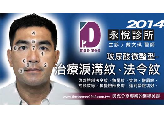 玻尿酸注射治療