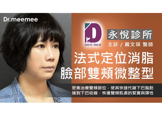 臉部.雙頰局部消脂